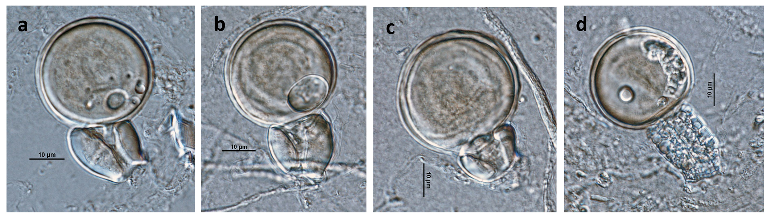   Phytophthora infestans  (A1 x A2) heterothallic sexual phase: (andash;d) smooth-walled oogonia with amphigynous antheridia and plerotic oospores; photos by Gloria Abad USDA-APHIS-PPQ. 
